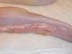 Woman Hospitalized To Remove Deer Tongue She Used To ‘Please’ Herself