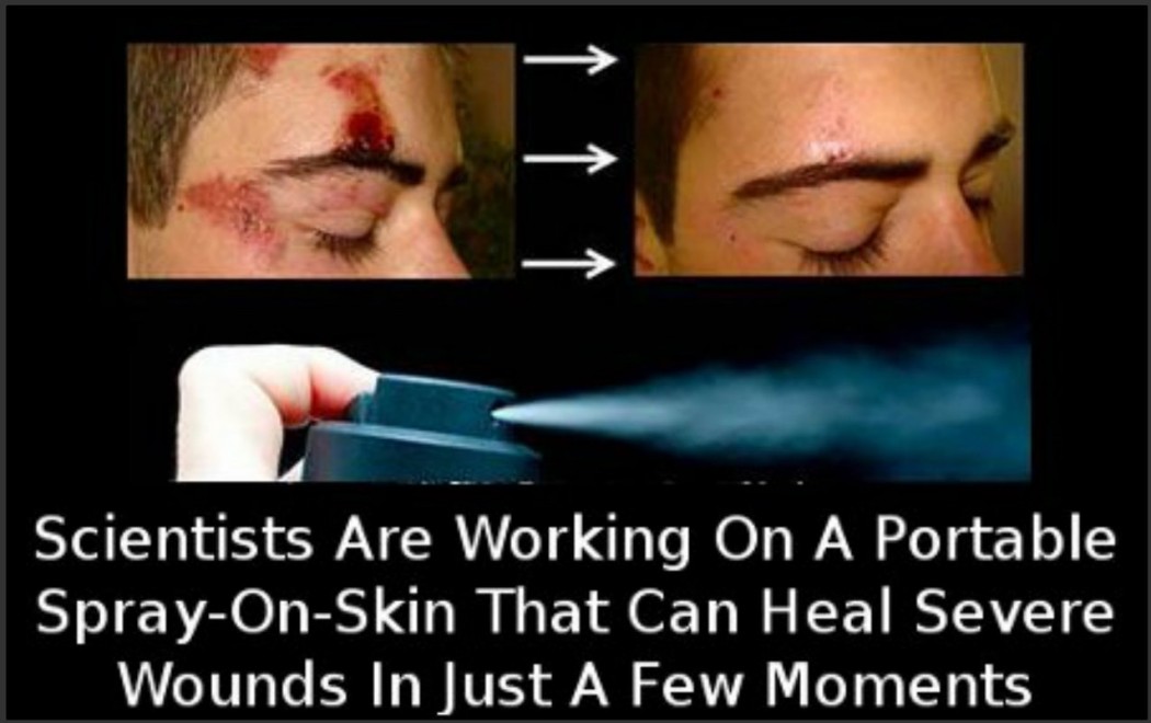 Healing Spray that Accelerates Skin Healing Super Fast