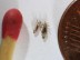 Eliminate Head Lice with This Simple, Safe and Natural Remedy